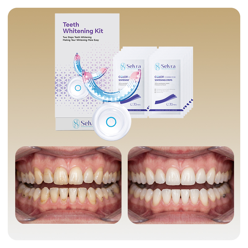 most effective at home teeth whitening strips kit most effective at home teeth whitening strips kit